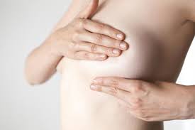 Irritation or dimpling of breast skin