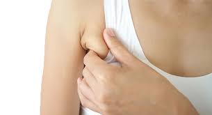 New lump in the breast or underarm