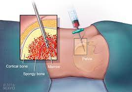 Diagnose and treat certain blood diseases