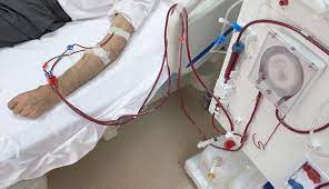 Haemodialysis