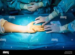 Dupuytrens Contracture Surgery