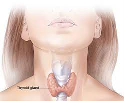 Hypothyroidism