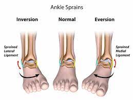 Ankle Injuries