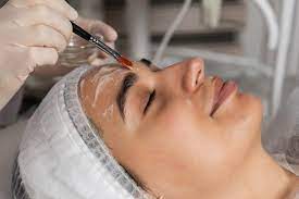 Chemical Peels