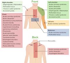 chest pain or discomfort