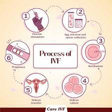 Mild Stimulation IVF