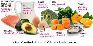 Vitamin A deficiency